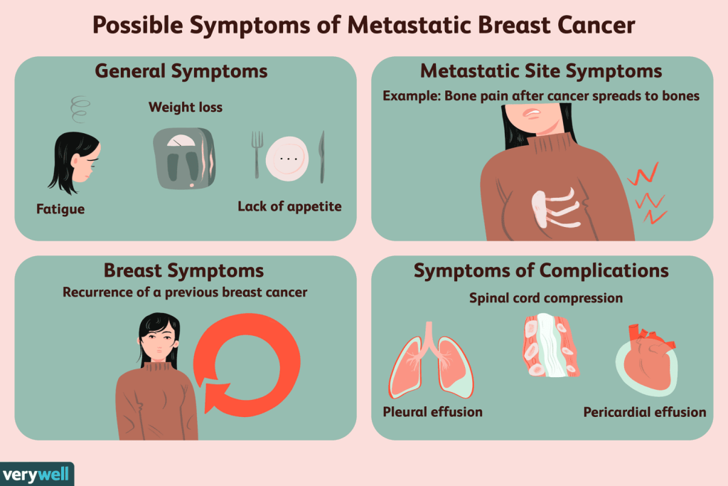 Symptoms of Metastatic Cancer?